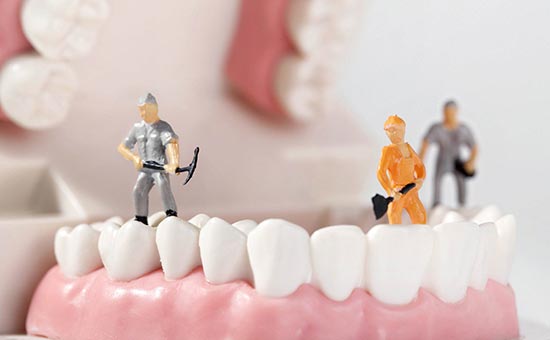 苏州口腔解答：补牙的时候为什么要磨牙?