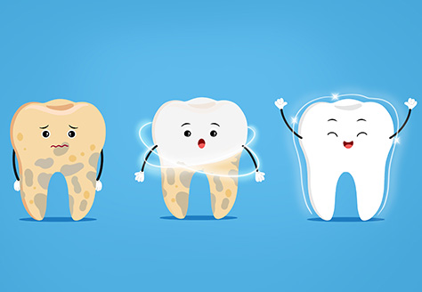 美白牙齿能持续多久？