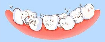 牙博士口腔可靠正畸治疗