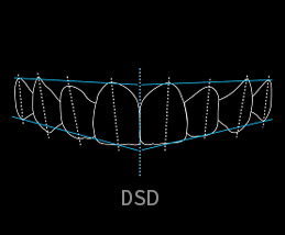 DSD数字美齿设计
