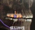 模拟种植