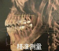精准测量