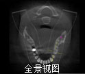 全景视图